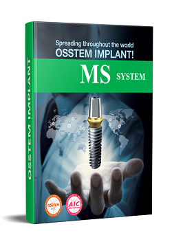 MS system